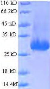 Rekombinant Epstein-Barr virüsü Trans-aktivatör proteini BZLF1 (BZLF1) (Rekombinant Protein)